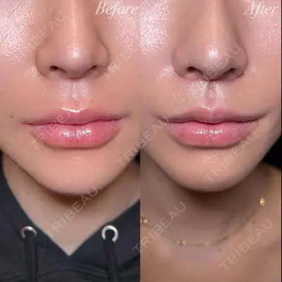 R Beauty CLINIC 大阪院 小池 泰弘医師の症例