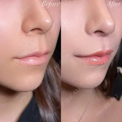 R Beauty CLINIC 大阪院 小池 泰弘医師の症例