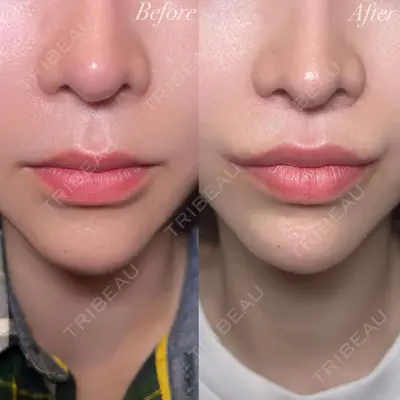 R Beauty CLINIC 大阪院 小池 泰弘医師の症例