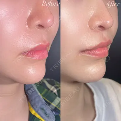 R Beauty CLINIC 大阪院 小池 泰弘医師の症例