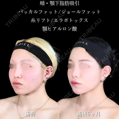 アリエル美容クリニック 大宮院 鈴木　桂介医師の症例