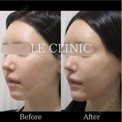 LE CLINICの症例