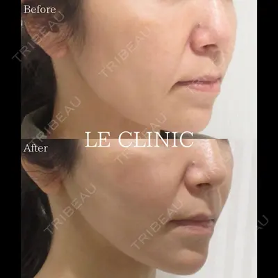 LE CLINICの症例