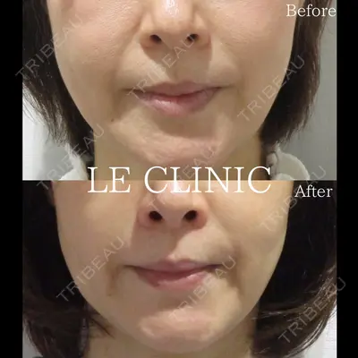 LE CLINICの症例