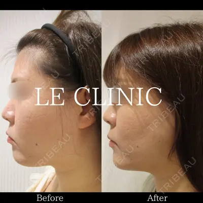 LE CLINICの症例