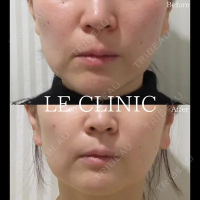 LE CLINICの症例
