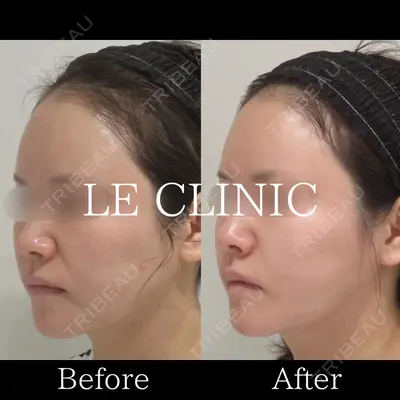 LE CLINICの症例