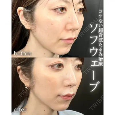 THE FIRST CLINIC 町田院の症例