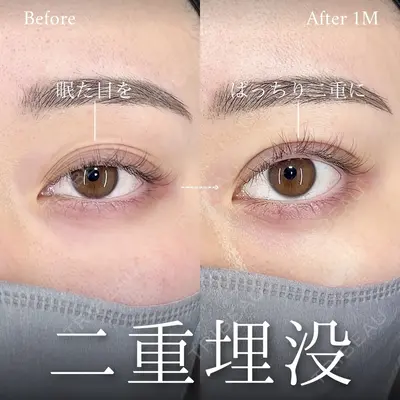 MAe Clinic 大阪院 前之園 健太医師の症例