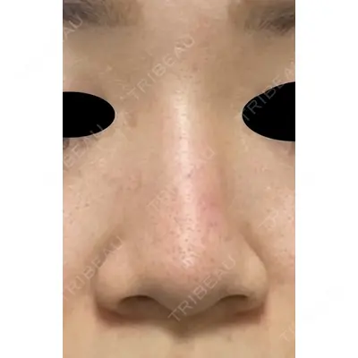 下北沢スキンクリニック 保坂 宗孝医師の症例