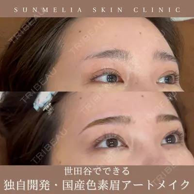 SUNMELIA SKIN CLINICの症例