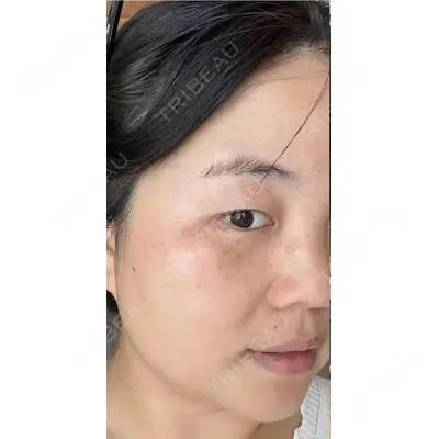 しんゆり美容健康クリニックの症例