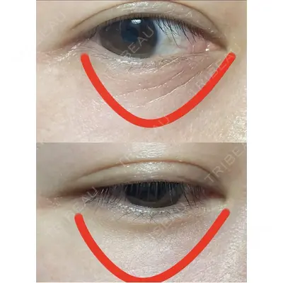 しんゆり美容健康クリニックの症例