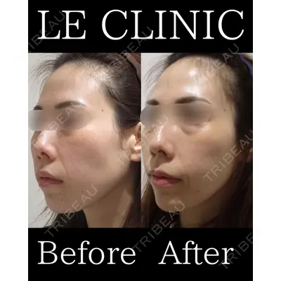 LE CLINICの症例