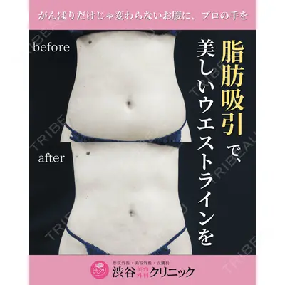 渋谷美容外科クリニック 渋谷院の症例