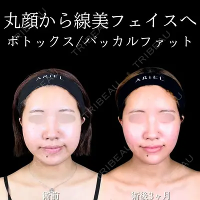 アリエル美容クリニック 大宮院 江郷隼一郎医師の症例