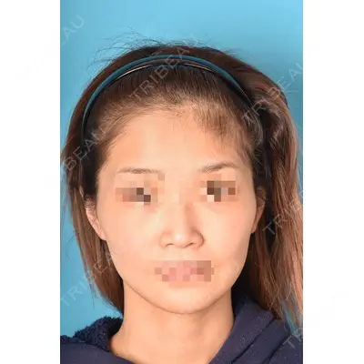 アネシス美容クリニック 水野　力医師の症例