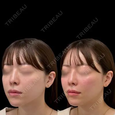 ルラ美容クリニック 池袋院 小海 元｜長期休暇につき指名不可医師の症例