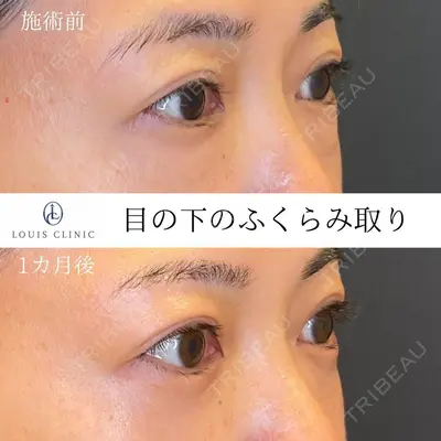 LOUIS CLINIC 二子玉川院【ルイクリニック】 小松 塁医師の症例
