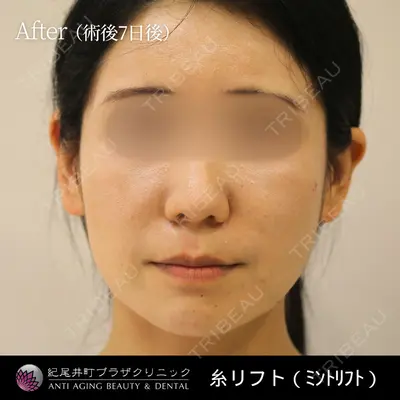 紀尾井町プラザクリニック 平井 春那医師の症例