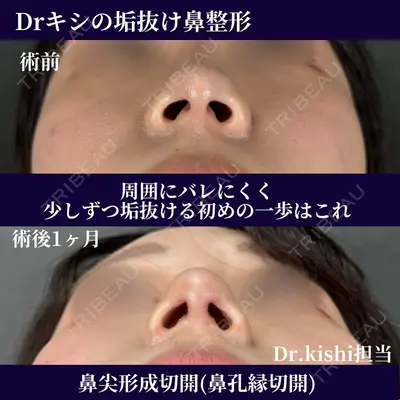 ネビュラクリニック 京都院 岸 大輔医師の症例