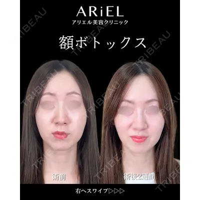 アリエル美容クリニック 横浜院 渡邉 光医師の症例