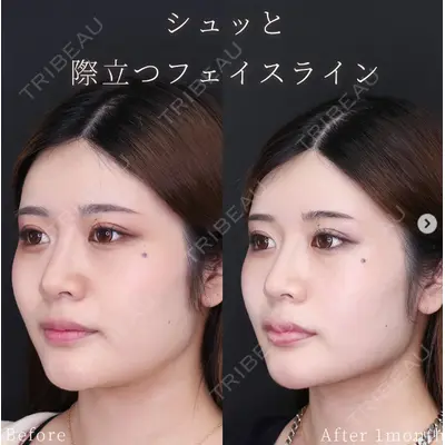高崎TAクリニック 小林 慧祐医師の症例