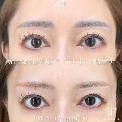 ziz CLINIC 村岡 史子医師の症例
