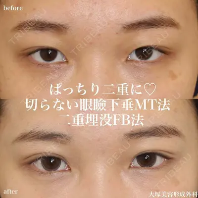 大塚美容形成外科 銀座本院 石井秀典医師の症例