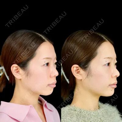 ルラ美容クリニック 池袋院 小海 元｜長期休暇につき指名不可医師の症例
