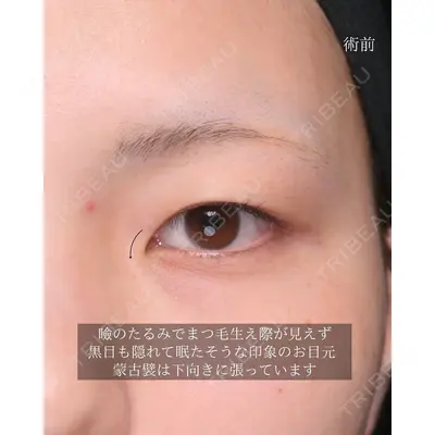 Zetith Beauty Clinic 大阪心斎橋院の症例