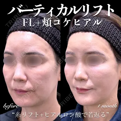 EMMO FACE CLINIC 大宮院 百瀬 直也医師の症例