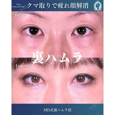 東京シンデレラ美容外科  横浜院 吉田 利之医師の症例