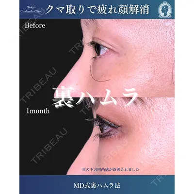 東京シンデレラ美容外科  横浜院 吉田 利之医師の症例