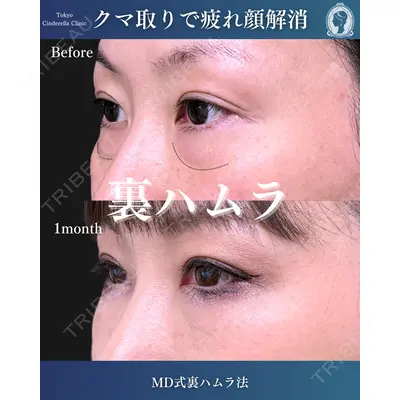 東京シンデレラ美容外科  横浜院 吉田 利之医師の症例