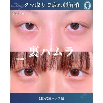 東京シンデレラ美容外科  横浜院 吉田 利之医師の症例