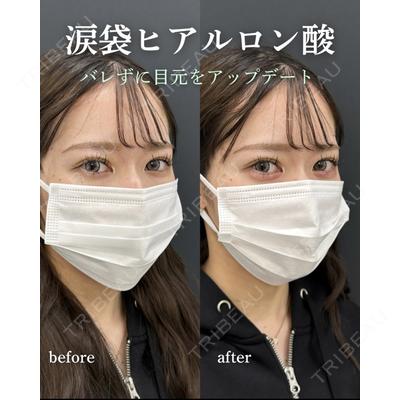ルラ美容クリニック 岐阜院 馬場 愛理医師の症例