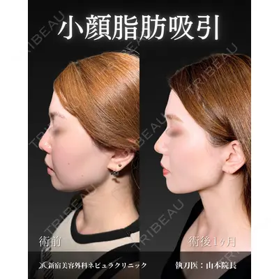 新宿美容外科ネビュラクリニック 山本 紘子医師の症例