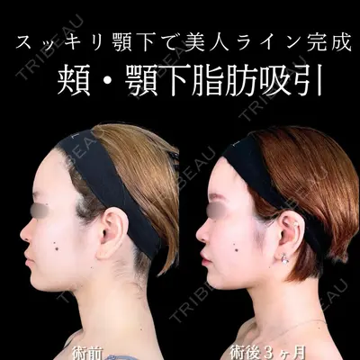 アリエル美容クリニック 大宮院 天白 典秀医師の症例