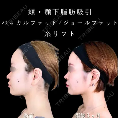 アリエル美容クリニック 大宮院 天白 典秀医師の症例