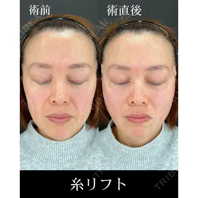 HAAB×DREAM BEAUTY CLINIC 大阪梅田院 柏木 太雅医師の症例