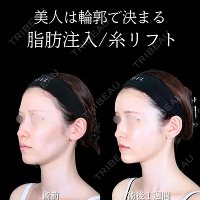 アリエル美容クリニック 大宮院 鈴木　桂介医師の症例
