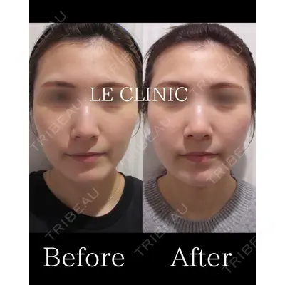LE CLINICの症例