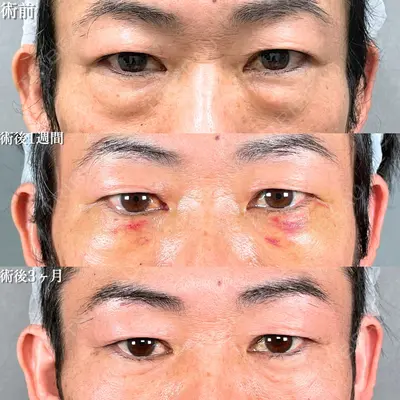 アリエル美容クリニック 大宮院 鈴木　桂介医師の症例