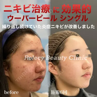 ロレシー美容クリニック 心斎橋駅前院 福留院長医師の症例