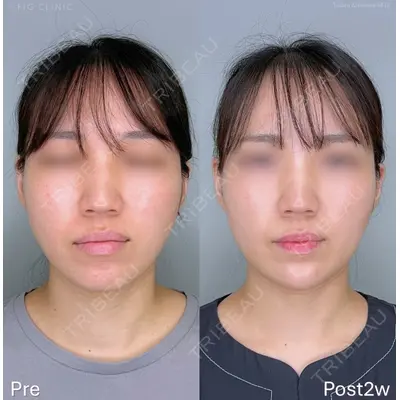 FIG CLINIC 喜多村 勇大朗医師の症例