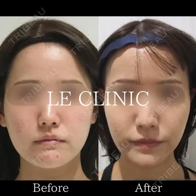 LE CLINICの症例