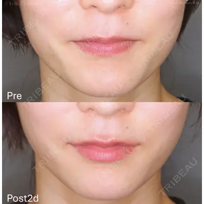 FIG CLINIC 喜多村 勇大朗医師の症例