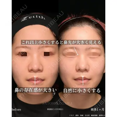 Zetith Beauty Clinic 銀座院 小川 悟史医師の症例