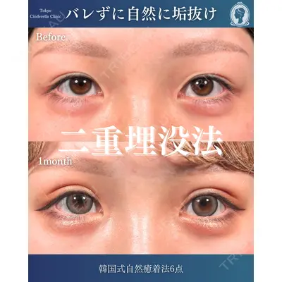 東京シンデレラ美容外科  横浜院 吉田 利之医師の症例